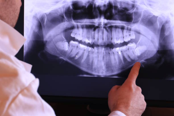 Best Emergency Treatment for Dental Infections or Abscesses in Mineral Wells, TX